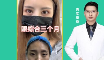 眼综合3个月效果